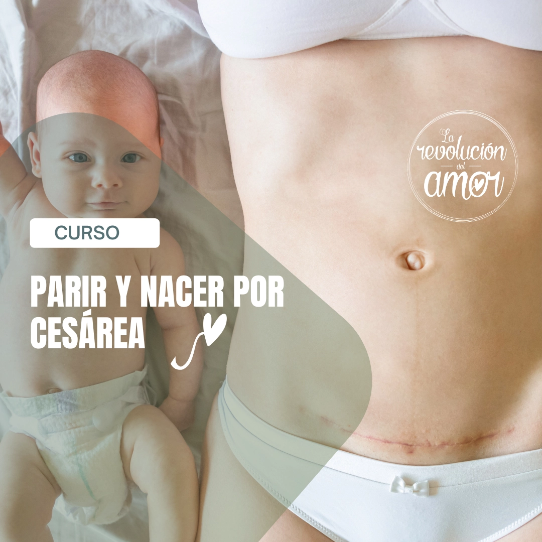 Parir y nacer por cesárea Parir y nacer por cesárea