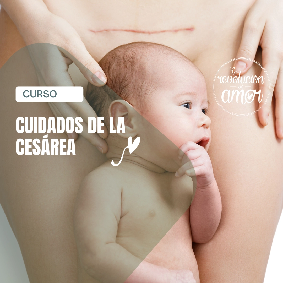 Cuidados de la cesárea Cuidados de la cesárea