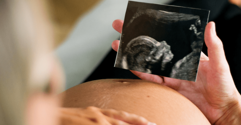 blog-debo-tomar-ácido-fólico-durante-embarazo (1)